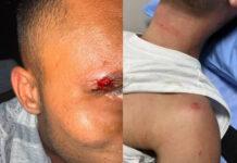 สื่ออิสราเอลอ้าง 3 นักท่องเที่ยวยิวถูกไล่ล่า–ทุบตี–ปล้นในบาร์สมุย หลังพูดฮีบรู ครอบครัวชี้มูลเหตุชาตินิยม